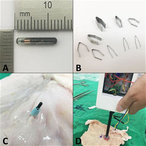 rf frequencies used on electronic tags|radio frequency tag localization lumpectomy.